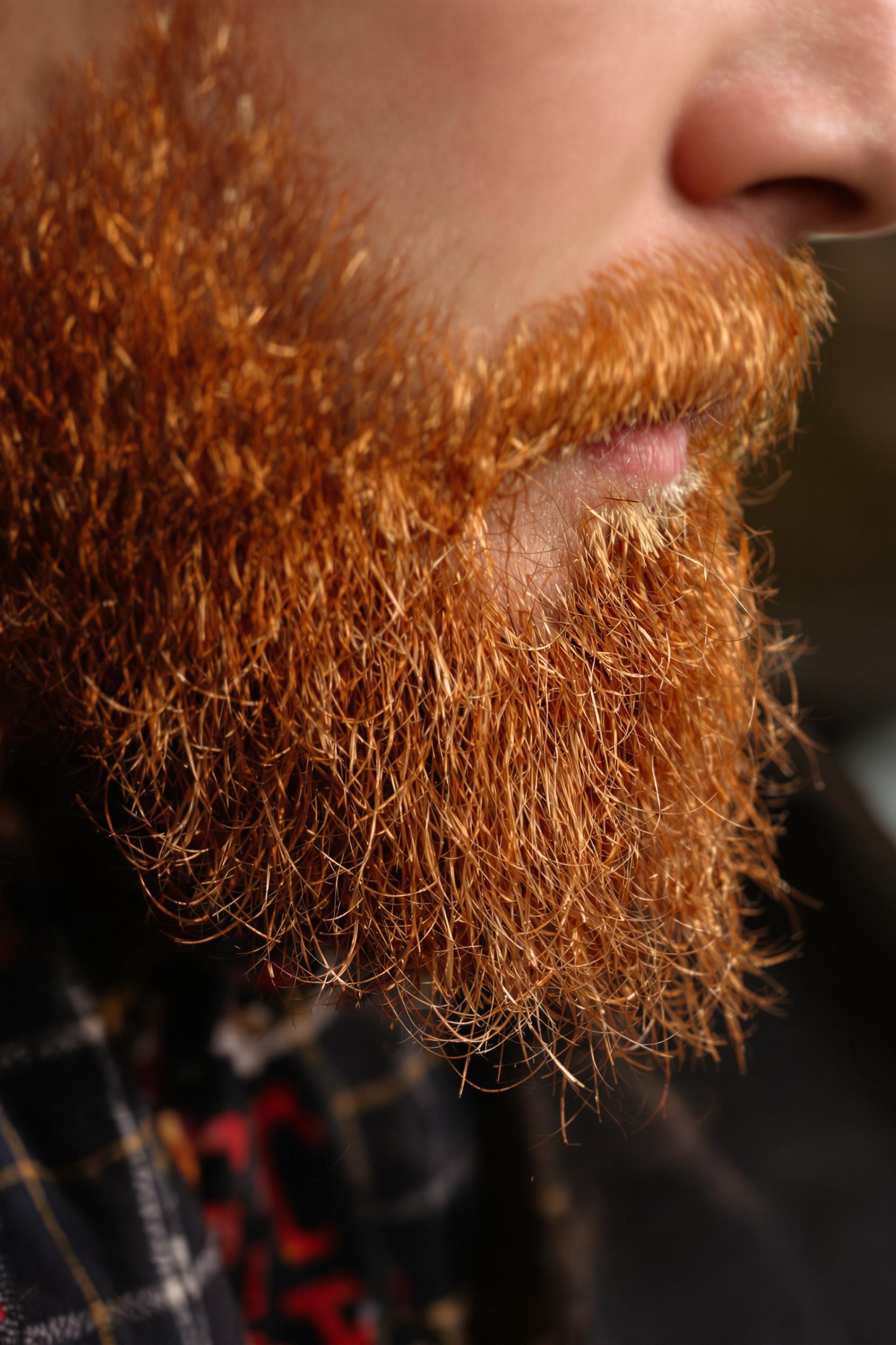 Fiery Red Beard Appeal